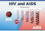 Topic 5: Human Immuno Deficiency (HIV), Acquired Immuno Deficiency Syndrome (AIDS), And Sexual Transmitted Infections (STI'S) - Biology Notes Form 4